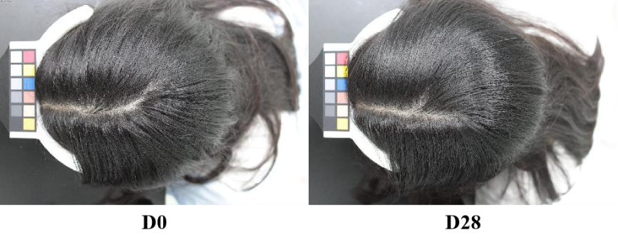 頭皮,健康,頭皮脫屑,頭皮皮脂