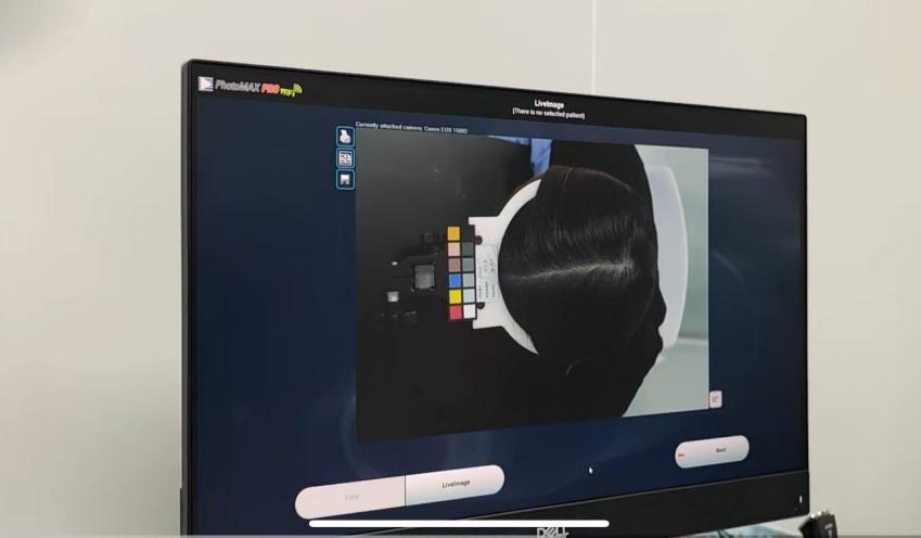 頭皮健康,紅斑,,丘疹,膿皰,評(píng)價(jià)方法