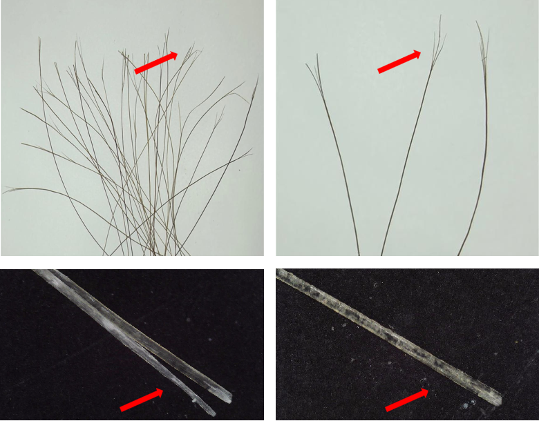 頭皮健康,紅斑,,丘疹,膿皰,評(píng)價(jià)方法