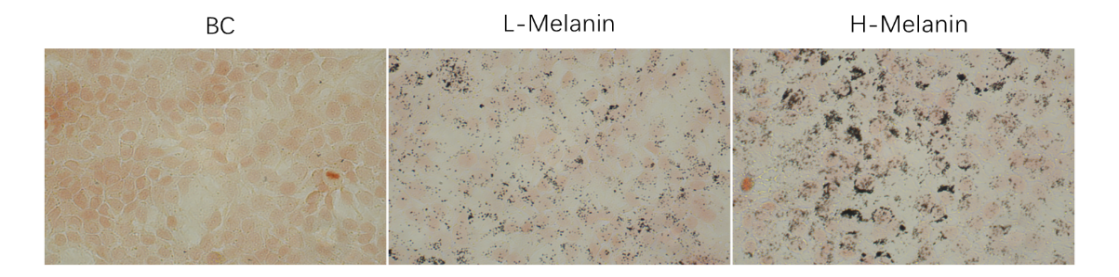 體外細胞,培養,模型,祛斑,美白,功效評估