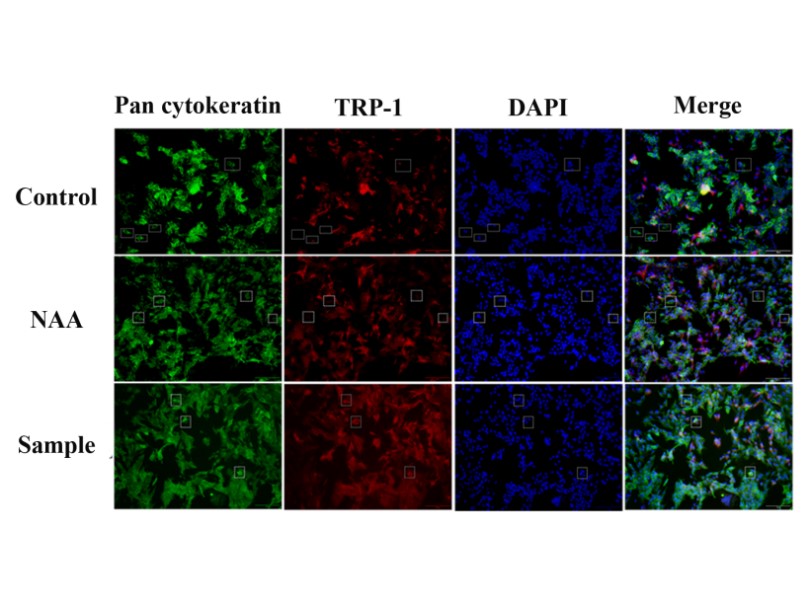 體外細胞,培養,模型,祛斑,美白,功效評估
